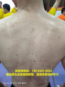 辟谷的注意事项 感冒期间可以辟谷吗